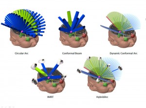 3D Radiation Treatment Planning