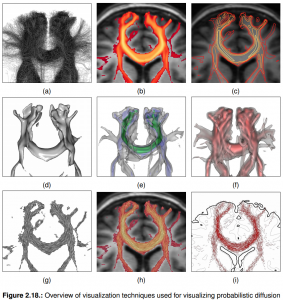 Figure 2.18 from Goldau's thesis: Overview of techniques for visualizing probabilistic diffusion tractography.